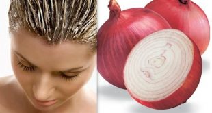 onion benefits for hair