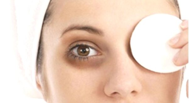download dark circle treatment download dark circle treatment