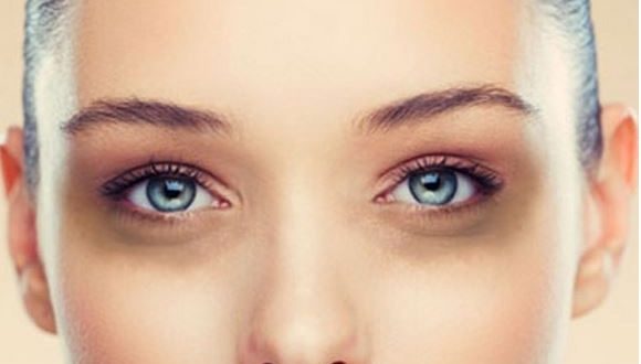 eye dark circle treatment